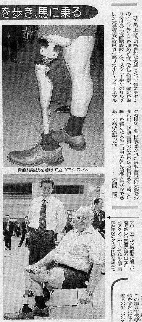 インプラント 大腿義足